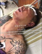 直播主吳小哲手腳遭打斷 警移送「包龍星」3人